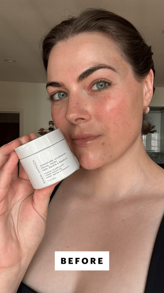Dall'Asen before applying the Shani Darden Signature Nourishing Facial Mask